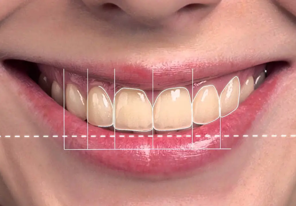 3 Descrição Ortodontia